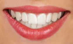 cler aligner